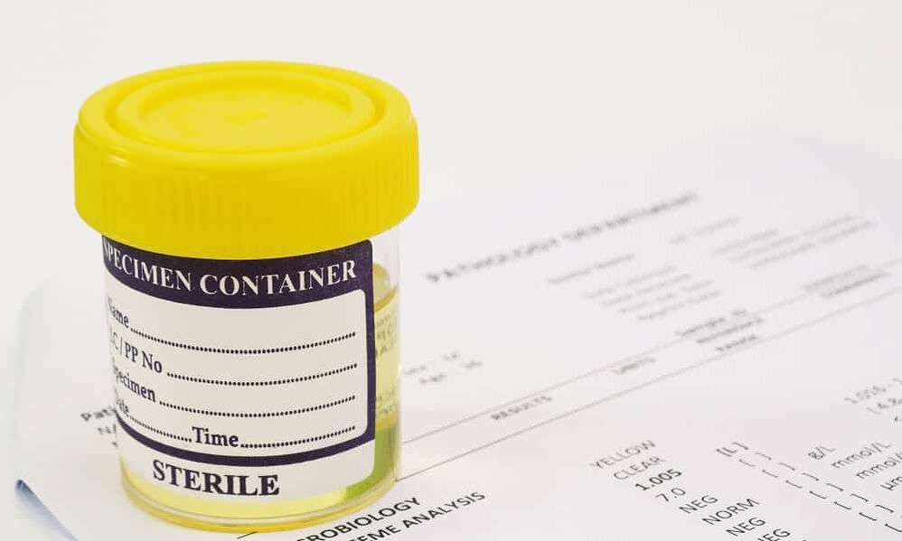 Trebuie să faceți un test de urină înainte de a lua antibiotice